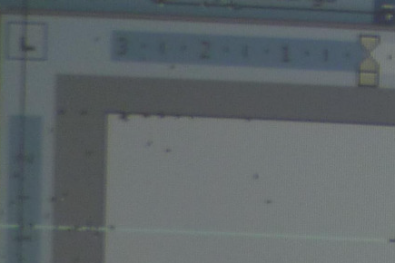 Stuck or dead pixels appear in the projected image
